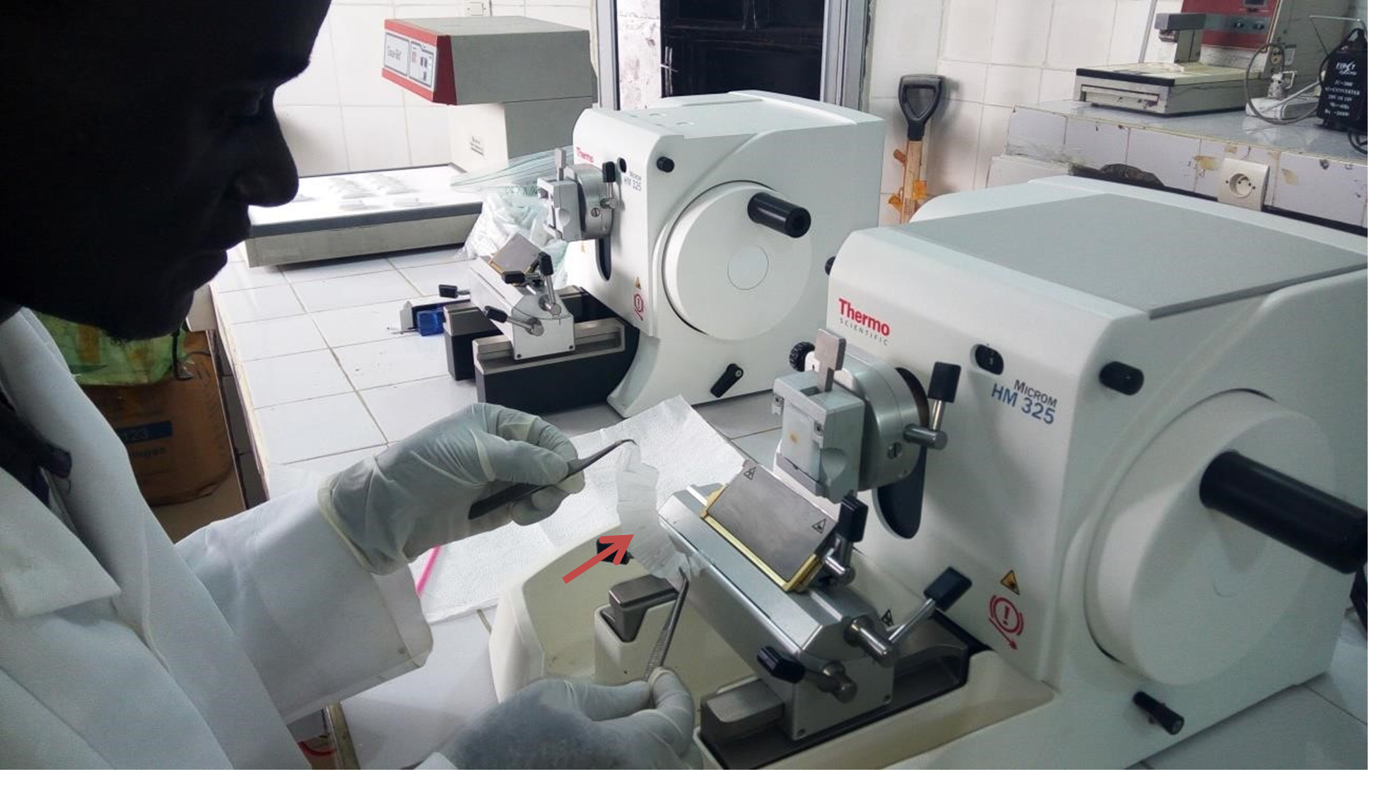 Tissue sectioning using a semi-automated microtome